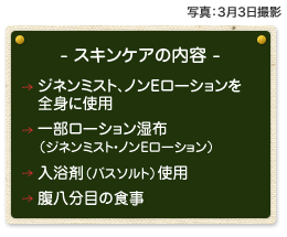 脱ステロイド スキンケアの内容