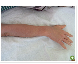 脱ステロイド 改善日記
2010年3月29日