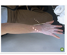 脱ステロイド 改善日記
2010年5月1日