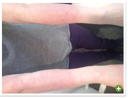 脱ステロイド 改善日記
2009年12月28日
初めてのご相談